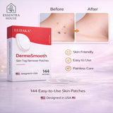 LUHAKA™ DermaSmooth Skin Tag Remover Patches (BUY 1 GET 1 FREE )